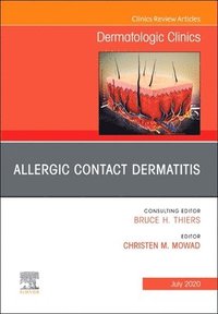 bokomslag Allergic Contact Dermatitis,An Issue of Dermatologic Clinics