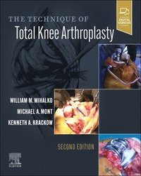 bokomslag The Technique of Total Knee Arthroplasty