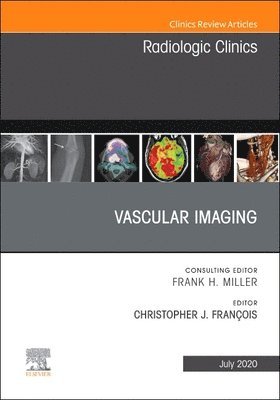 bokomslag Vascular Imaging, An Issue of Radiologic Clinics of North America