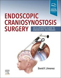 bokomslag Endoscopic Craniosynostosis Surgery