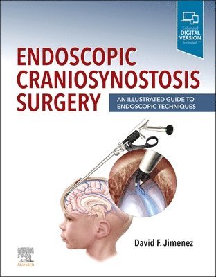 bokomslag Endoscopic Craniosynostosis Surgery