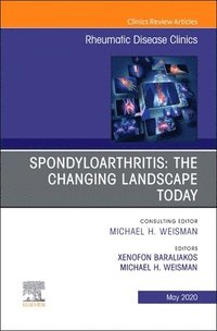 bokomslag Spondyloarthritis: The Changing Landscape Today, An Issue of Rheumatic Disease Clinics of North America