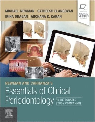 Newman and Carranza's Essentials of Clinical Periodontology 1