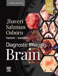 bokomslag Diagnostic Imaging: Brain