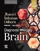 Miral D. Jhaveri, Illinois) Jhaveri, Miral D. (Colonel Robert R. McCormick Professor of Diagnostic Imaging, Division Head, Neuroradiology Chair, Department of Diagnostic Radiology and Nuclear Medicine, Rush University Medical Center, Chicago, Miral D Jhaveri - Diagnostic Imaging: Brain, Inbunden
