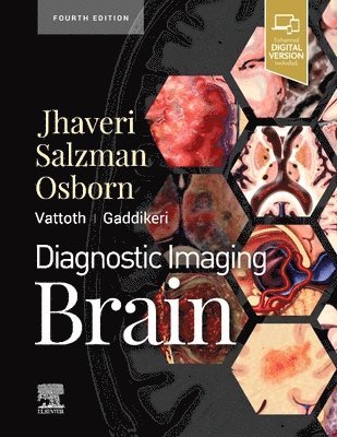 Diagnostic Imaging: Brain 1