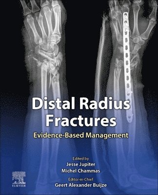 Geert Alexander Buijze, Jesse Jupiter, Michel Chammas, Netherlands.) Buijze, Geert Alexander, MD PhD, Hand Surgeon (Hand and upper limb surgeon,  Clinique Generale d'Annecy, France. Assistant Professor, University Hospital CHU Montpellier, France, Postdoc, Amsterdam UMC, USA) Jupiter, Jesse, MD (Hansjoerg Wyss/AO Professor, Harvard Medical School, Department Of Orthopedic Surgery, Massachusetts General Hospital, Past President, American Shoulder and Elbow Surgeons, Past President, American Association of Hand Surgery, France) Chammas, Michel, MD, PhD (Professor, Orthopaedic Hand and Upper Extremity Trauma Surgery, University of Montpellier - Distal Radius Fractures, Inbunden