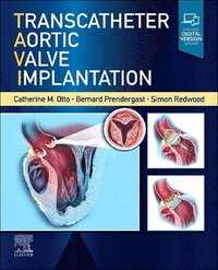 bokomslag Transcatheter Aortic Valve Implantation