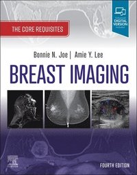 bokomslag Breast Imaging