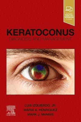 bokomslag Keratoconus