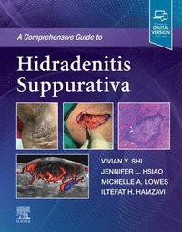 bokomslag A Comprehensive Guide to Hidradenitis Suppurativa