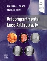Richard D. Scott, Vivek Shah - Unicompartmental Knee Arthroplasty, Inbunden