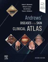 bokomslag Andrews' Diseases of the Skin Clinical Atlas