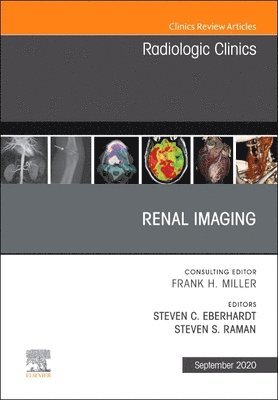 Steven C. Eberhardt, Steven Raman, Steven C Eberhardt - Renal Imaging, An Issue of Radiologic Clinics of North America, Inbunden