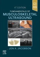 Jon A. Jacobson - Fundamentals of Musculoskeletal Ultrasound, Häftad