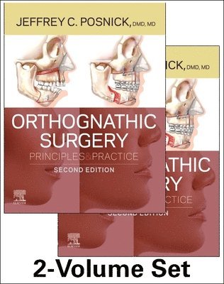 Orthognathic Surgery - 2 Volume Set 1