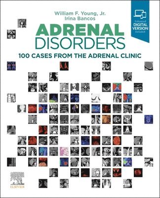 bokomslag Adrenal Disorders