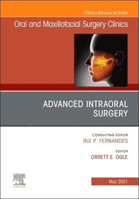 Advanced Intraoral Surgery, An Issue of Oral and Maxillofacial Surgery Clinics of North America 1