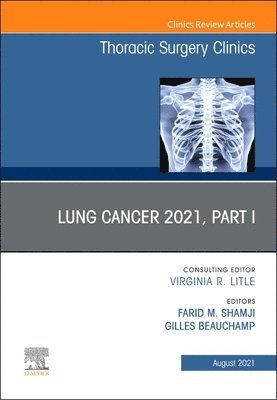 bokomslag Lung Cancer 2021, Part 1, An Issue of Thoracic Surgery Clinics