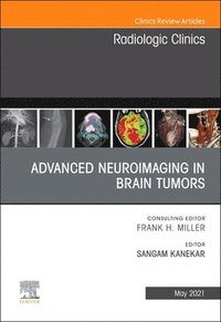 bokomslag Advanced Neuroimaging in Brain Tumors, An Issue of Radiologic Clinics of North America