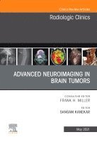 Sangam Kanekar - Advanced Neuroimaging in Brain Tumors, An Issue of Radiologic Clinics of North America, Inbunden