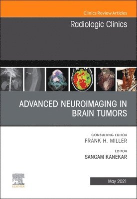 Advanced Neuroimaging in Brain Tumors, An Issue of Radiologic Clinics of North America 1