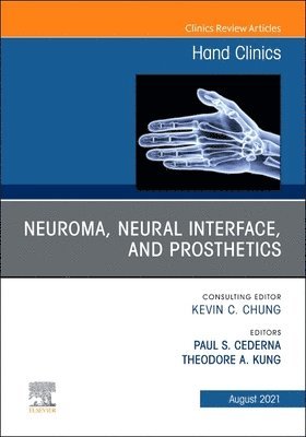 Neuroma, Neural interface, and Prosthetics, An Issue of Hand Clinics 1