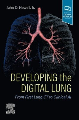 John D. Newell, USA) Newell, John D. (University of Colorado, Health Sciences Center, Denver, CO - Developing the Digital Lung, Häftad
