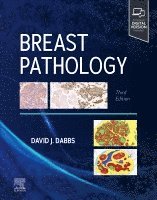 David J. Dabbs - Breast Pathology, Inbunden