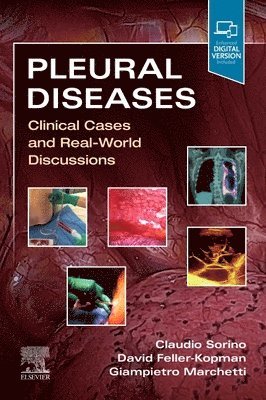 bokomslag Pleural Diseases