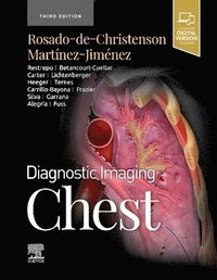 bokomslag Diagnostic Imaging: Chest