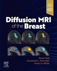 bokomslag Diffusion MRI of the Breast