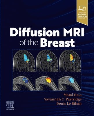 Diffusion MRI of the Breast 1