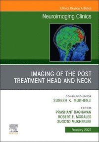 bokomslag Imaging of the Post Treatment Head and Neck, An Issue of Neuroimaging Clinics of North America