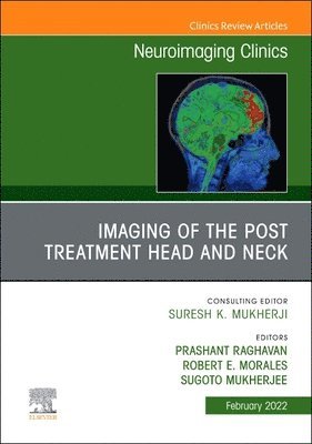 Imaging of the Post Treatment Head and Neck, An Issue of Neuroimaging Clinics of North America 1