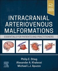 bokomslag Intracranial Arteriovenous Malformations