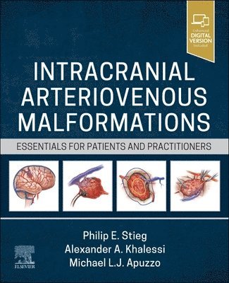 Philip E. Stieg, Alexander Khalessi, Michael L. J. Apuzzo - Intracranial Arteriovenous Malformations, Inbunden