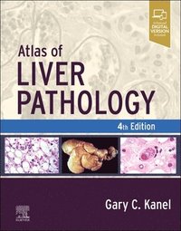 bokomslag Atlas of Liver Pathology