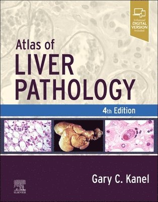 Atlas of Liver Pathology 1