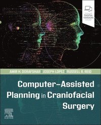 bokomslag Computer-Assisted Planning in Craniofacial Surgery