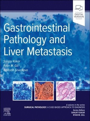 bokomslag Gastrointestinal Pathology and Liver Metastasis: A Case-Based Approach to Diagnosis