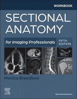 Monica Breedlove - Workbook for Sectional Anatomy for Imaging Professionals, Häftad