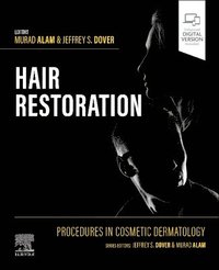bokomslag Procedures in Cosmetic Dermatology: Hair Restoration