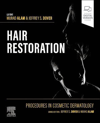 Procedures in Cosmetic Dermatology: Hair Restoration 1