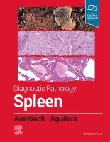 Aaron Auerbach, Nadine Aguilera - Diagnostic Pathology: Spleen, Inbunden