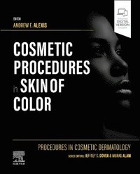 bokomslag Procedures in Cosmetic Dermatology: Cosmetic Procedures in Skin of Color