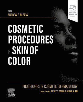 Procedures in Cosmetic Dermatology: Cosmetic Procedures in Skin of Color 1