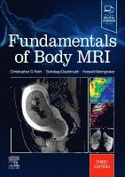 Christopher G. Roth, Haresh Naringrekar, Sandeep Deshmukh - Fundamentals of Body MRI, Häftad