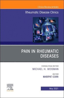 Pain in Rheumatic Diseases, An Issue of Rheumatic Disease Clinics of North America 1