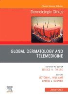 Victoria Williams, Carrie Kovarik - Global Dermatology and Telemedicine, An Issue of Dermatologic Clinics, Inbunden